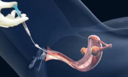 福州有一家第三代试管婴儿机构怎么样？福州生殖医院排名